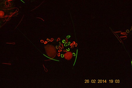Spermatidi di lombrico in evoluzione - DiBr - FITC